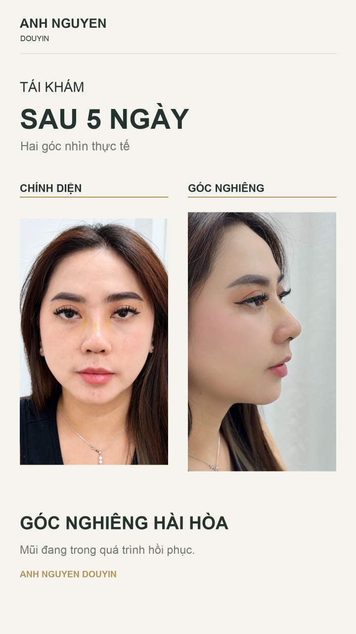 Khách hàng tái khám sau 5 ngày
